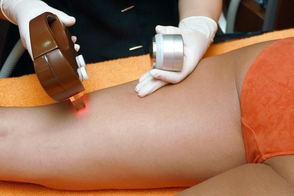 How Should You Choose a Laser Hair Removal Clinic in San Diego