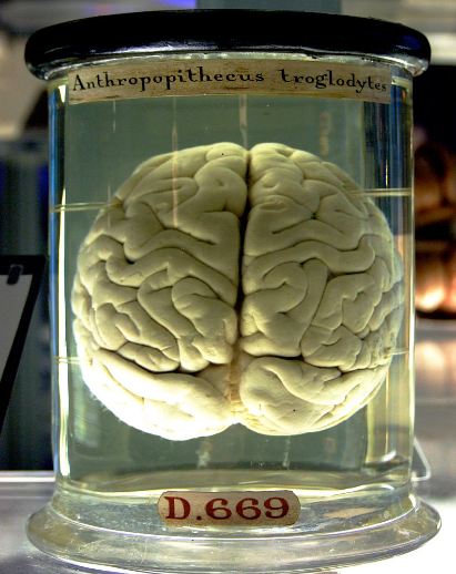 A brain from the science museum